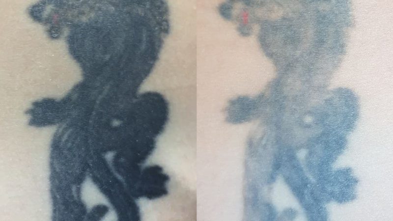 Почему татуировки синеют?